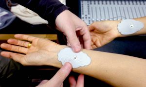 Art-a-Hack electro-cardiogram pads applied